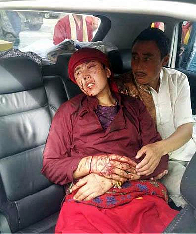 Another Victim of China's Ministry Of Security-Mr. Jangchup Dorjee, Severely Injured July 6, 2013 In Tawu, Kham, Eastern Tibet For Celebrating Birthday Of The Dalai Lama